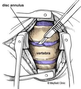 Courtesy Mayfield Clinic