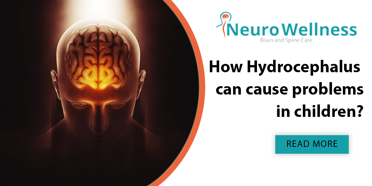 How Hydrocephalus can cause problems in children