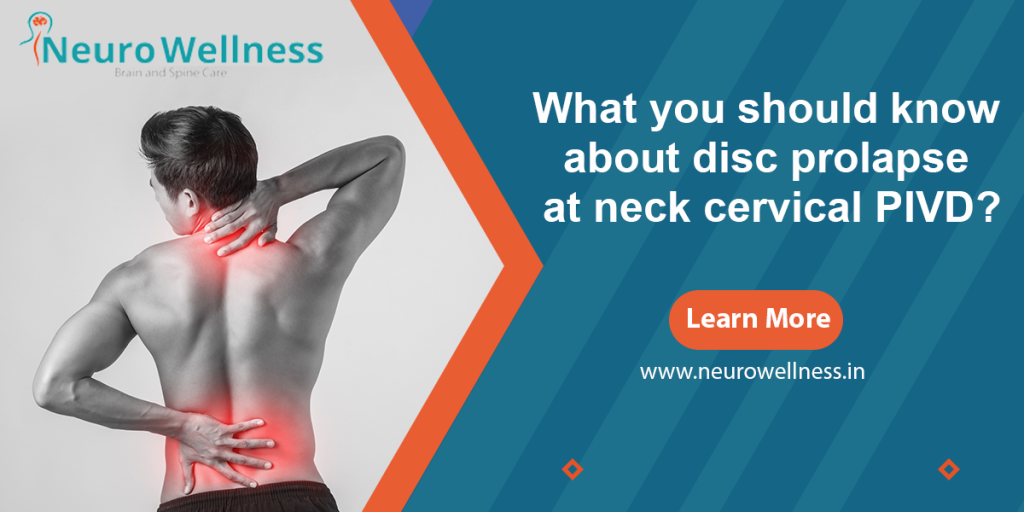 What you should know about disc prolapse at neck cervical PIVD