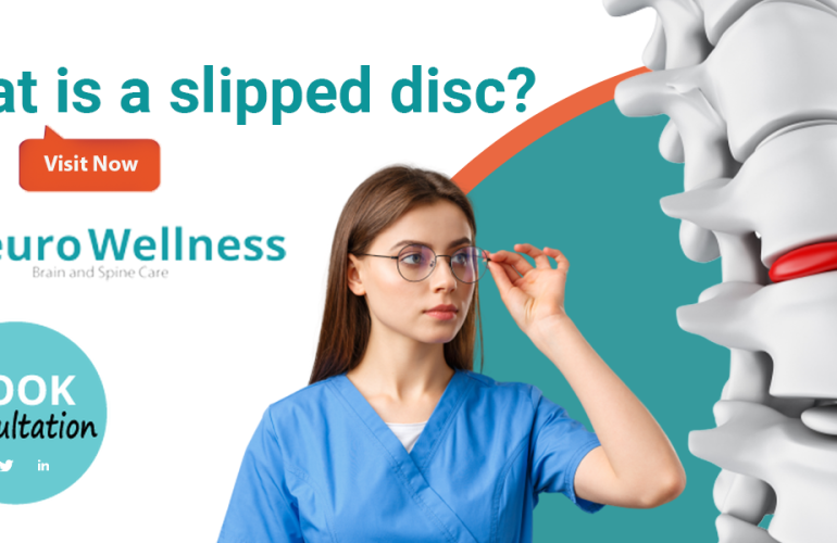 slipped disc