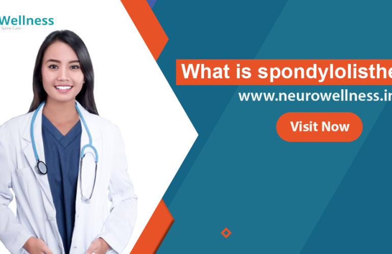 spondylolisthesis