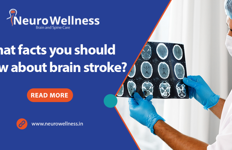 What facts you should know about brain stroke?