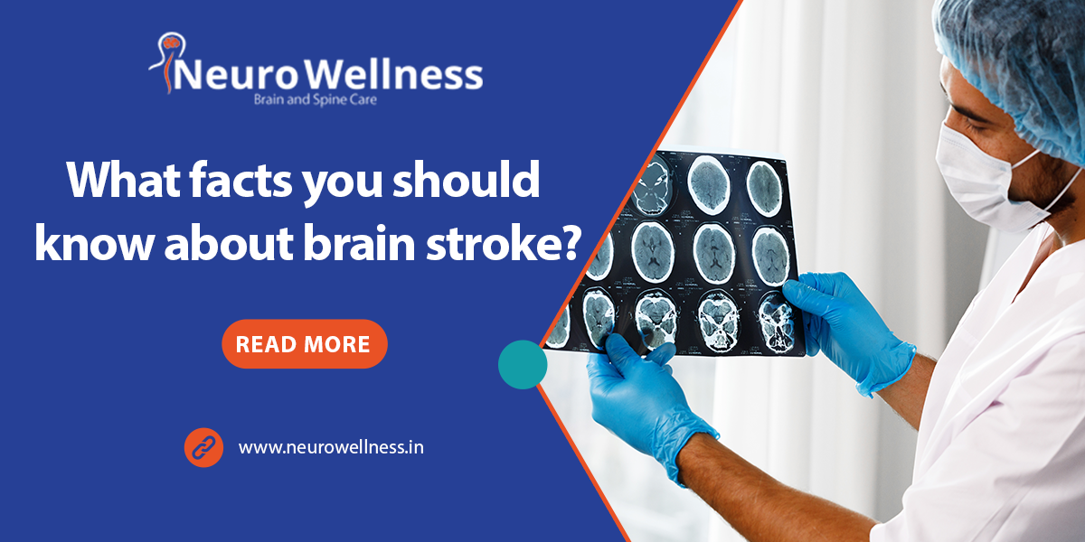 What facts you should know about brain stroke? | Advanced Stroke ...