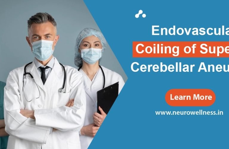 Endovascular Coiling of Superior Cerebellar Aneurysm
