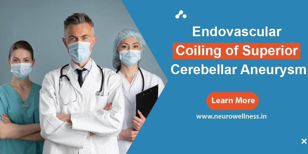 Endovascular Coiling of Superior Cerebellar Aneurysm
