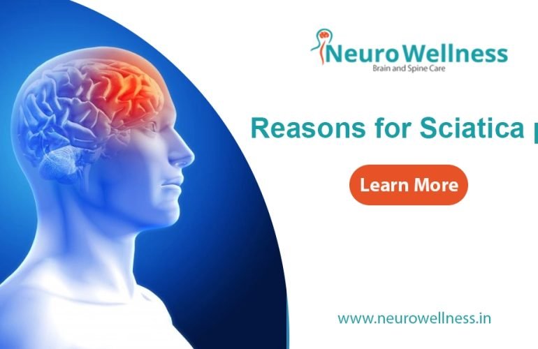 Reasons for Sciatica Pain