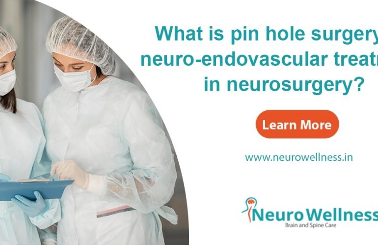 neuro-endovascular treatment in neurosurgery
