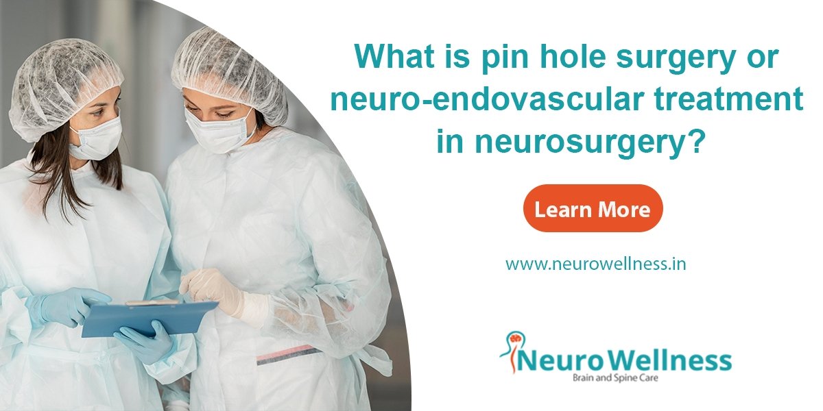 neuro-endovascular treatment in neurosurgery