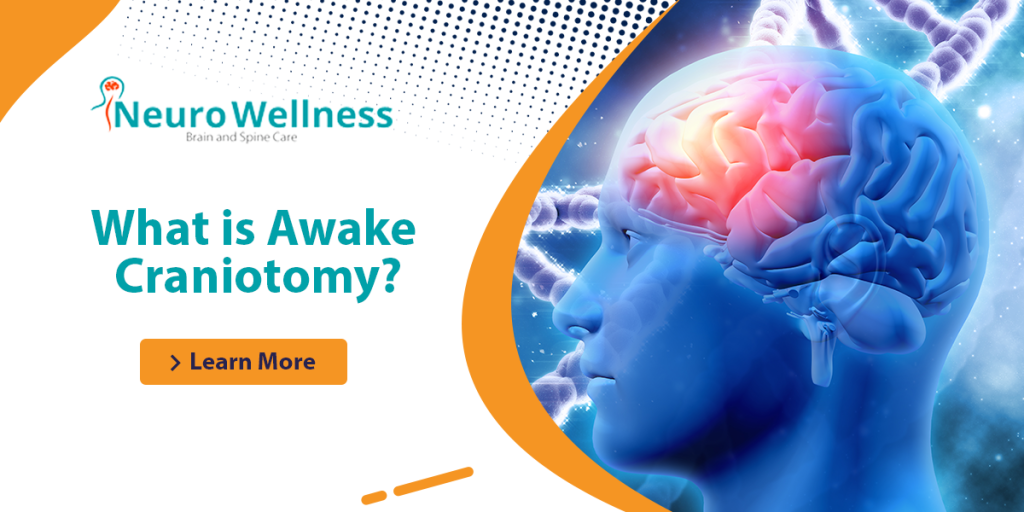 What is Awake Craniotomy?
