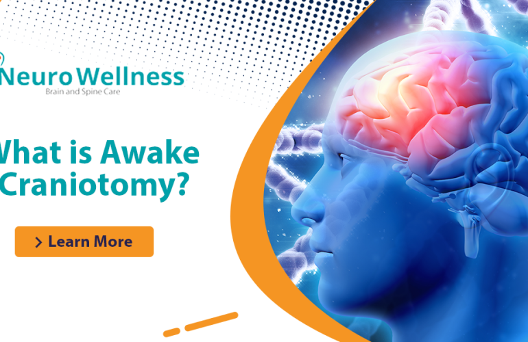 What is Awake Craniotomy?