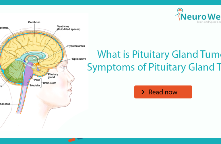 What is Pituitary Gland Tumor? Symptoms of Pituitary Gland Tumor