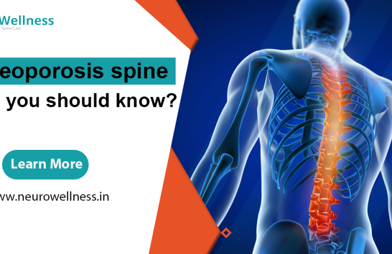 Osteoporosis spine: – what you should know?