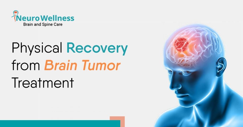 Brain Tumor Treatment in Bangalore