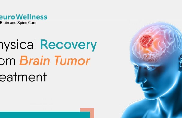 Brain Tumor Treatment in Bangalore