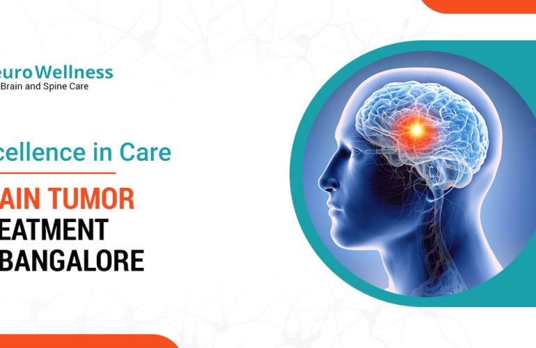 Excellence in Care: Brain Tumor Treatment in Bangalore