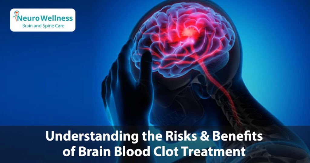 Understanding the Risks and Benefits of Brain Blood Clot Treatment