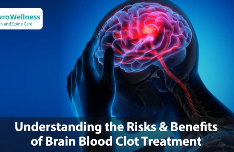 Understanding the Risks and Benefits of Brain Blood Clot Treatment