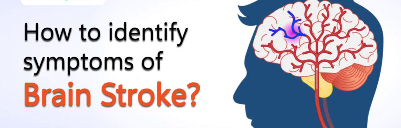 How to Identify Symptoms of Brain Stroke