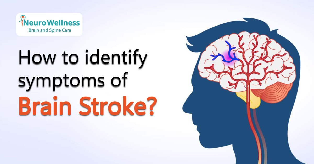 How to Identify Symptoms of Brain Stroke