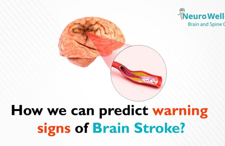 How can we predict warning signs of Brain Stroke?