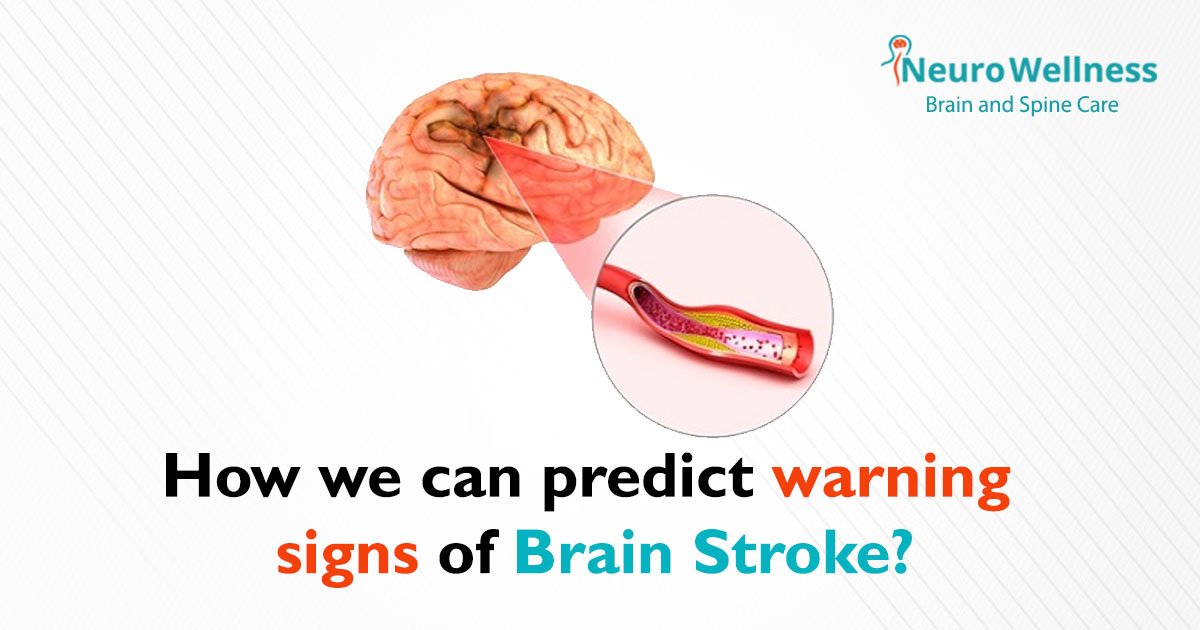 How can we predict warning signs of Brain Stroke?