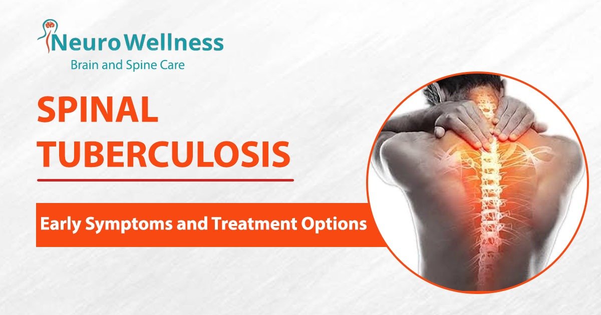 Spinal Tuberculosis: Early Symptoms and Treatment Options