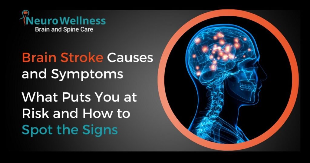 brain stoke