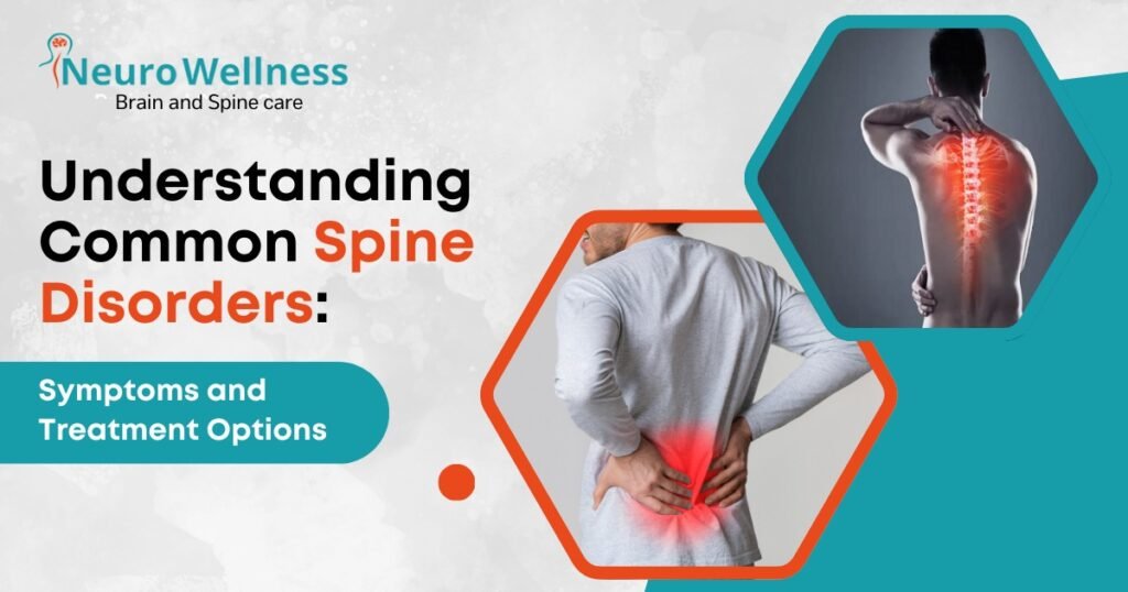 Spine Disorders