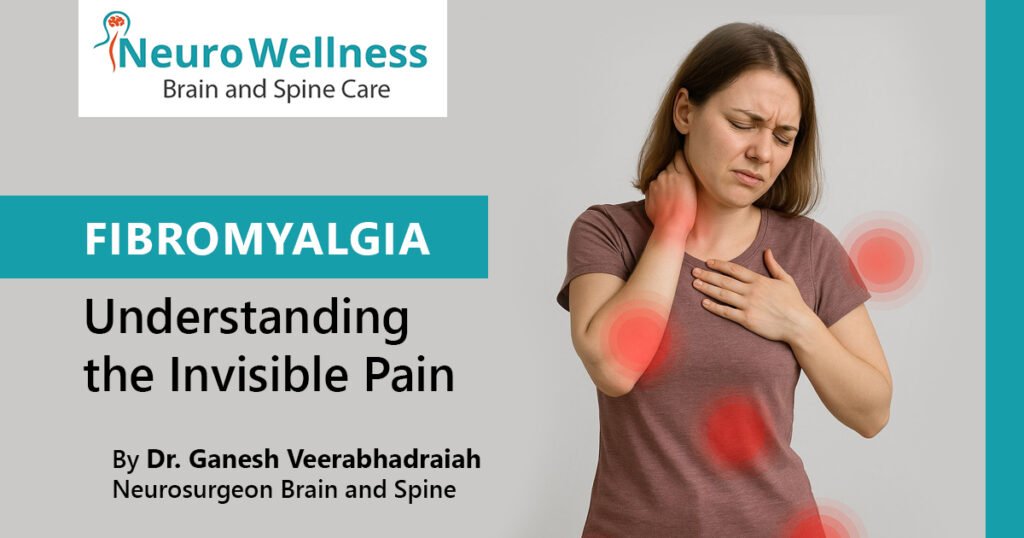 Fibromyalgia
