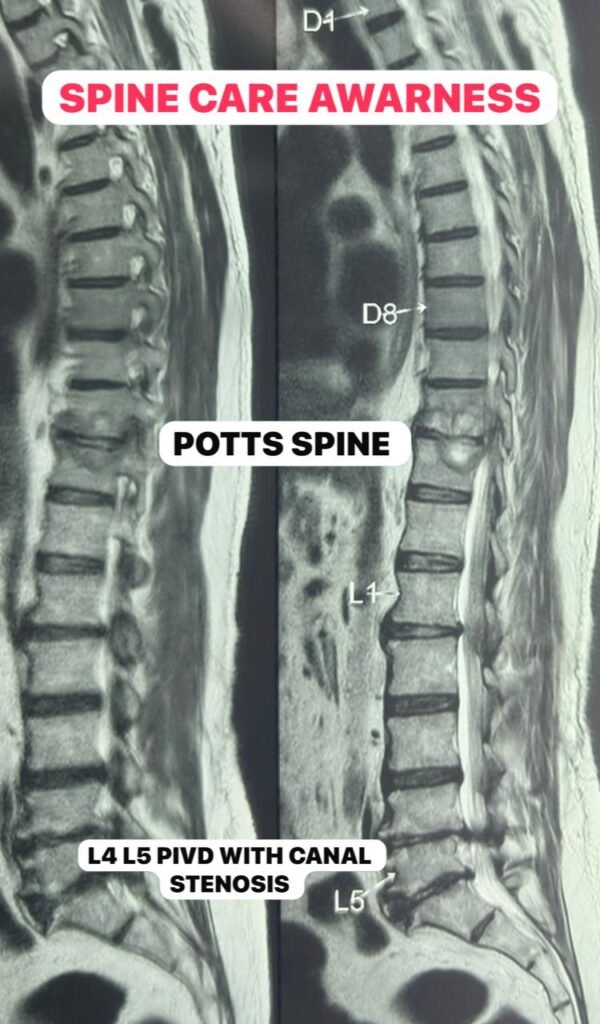 spine care