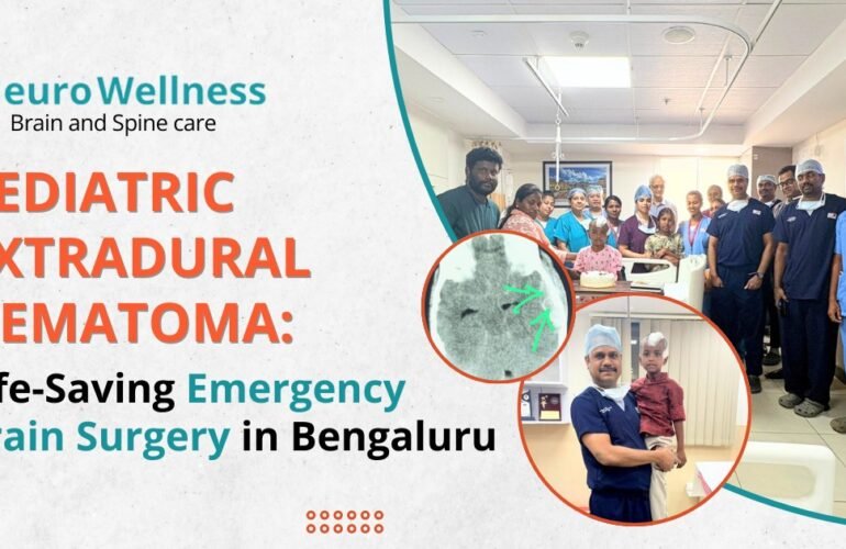 Pediatric Extradural Hematoma