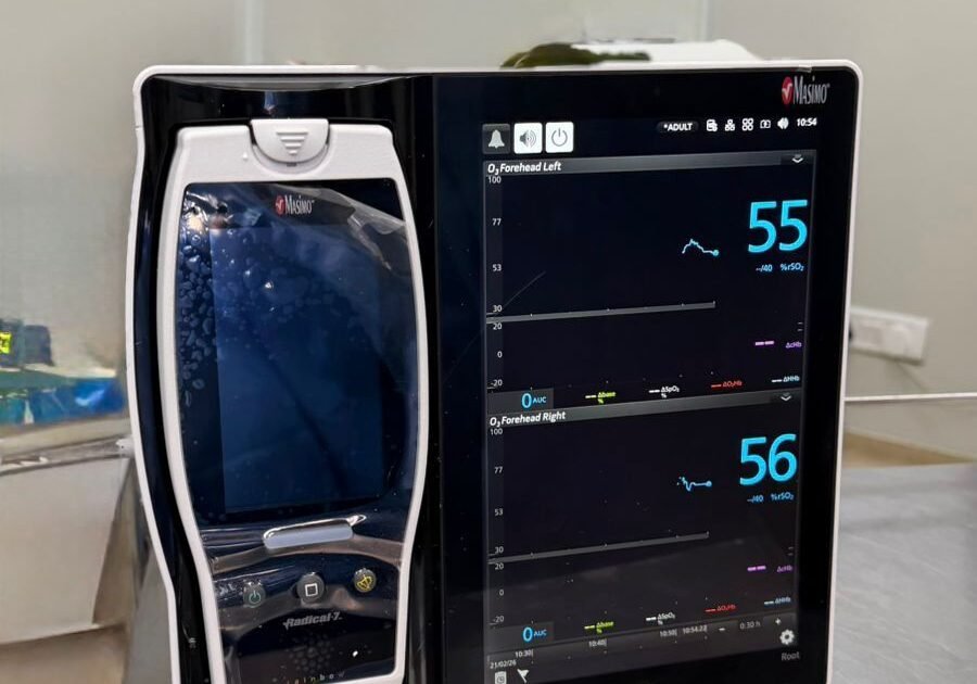 NIRS brain monitoring system displaying real-time cerebral oxygen levels during surgery.